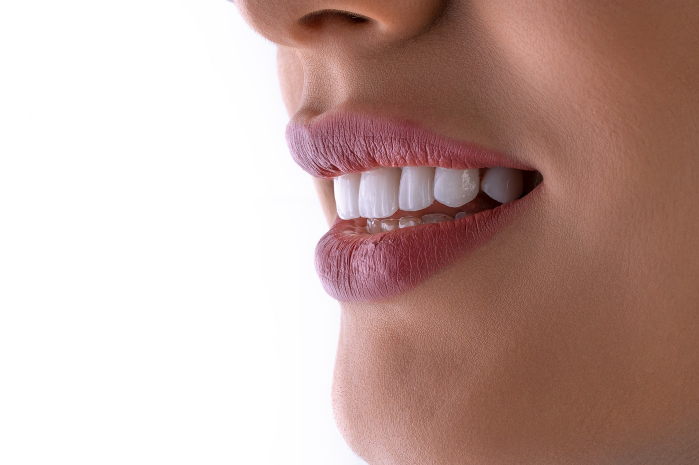 Close-up of a healthy, confident smile